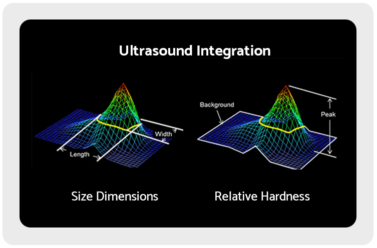 BEXA ultrasound integration visualization